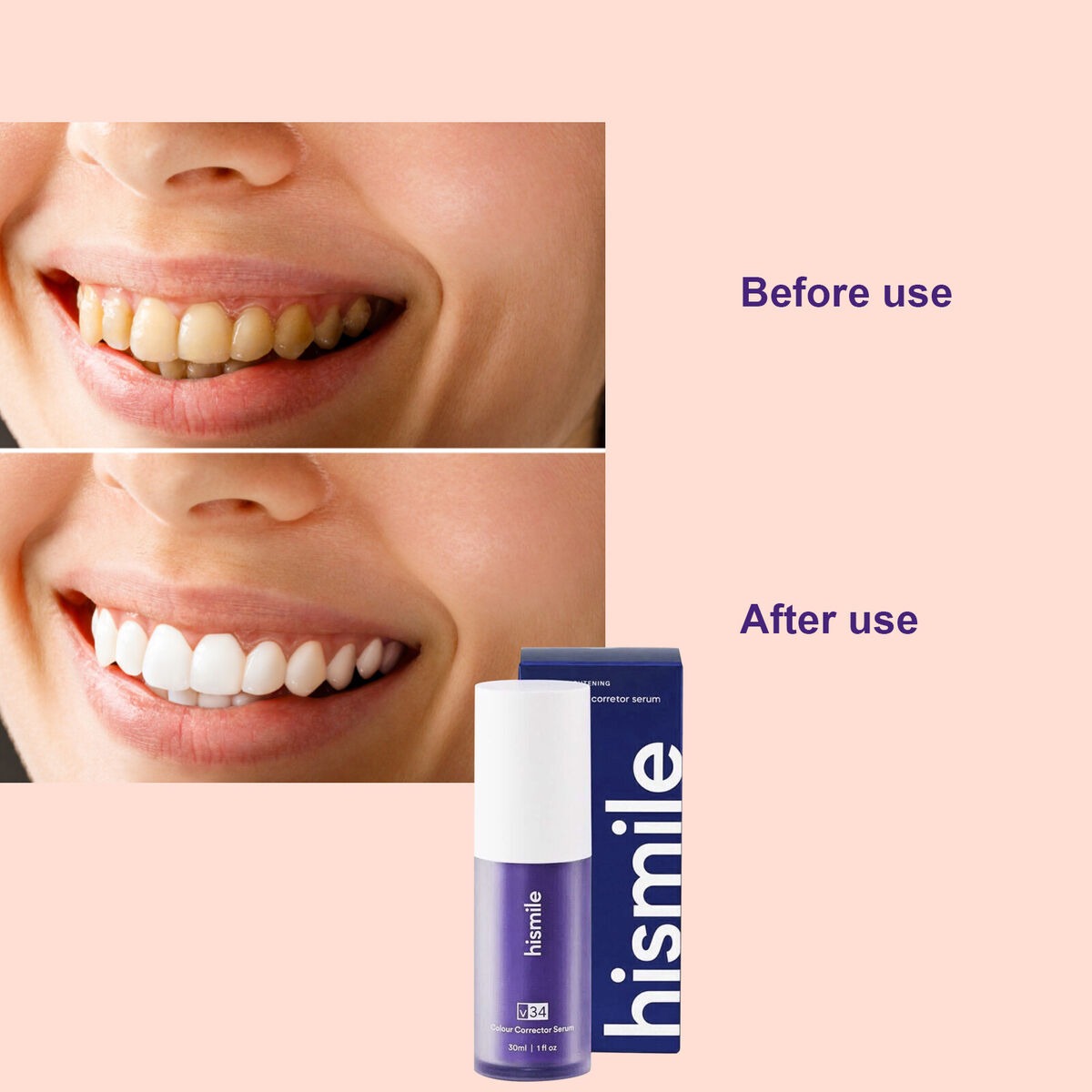 HISMILE V34 Purple Teeth Whitening Toothpaste Kit β Deep Stain Removal, Gingiva Protection & Color Correction