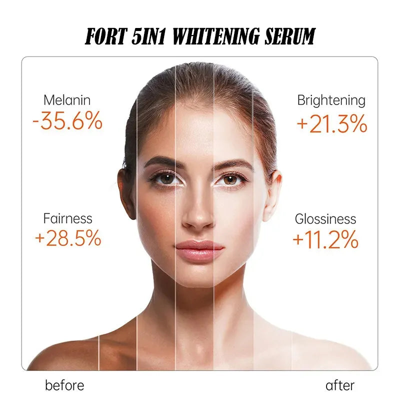 FORT 5IN1 Whitening Serum | Brighten Skin Tone, Removes Dead Skin Whitening Serum | 30ML