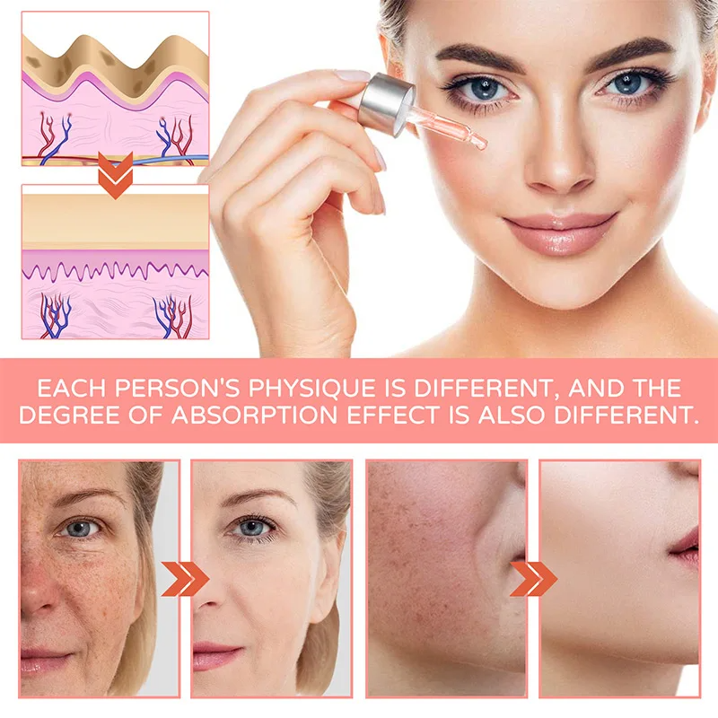 FORT 5IN1 Whitening Serum | Brighten Skin Tone, Removes Dead Skin Whitening Serum | 30ML