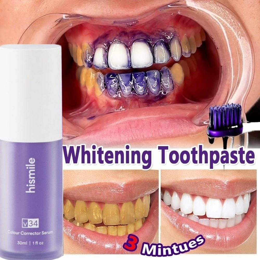 HISMILE V34 Purple Teeth Whitening Toothpaste Kit – Deep Stain Removal, Gingiva Protection & Color Correction