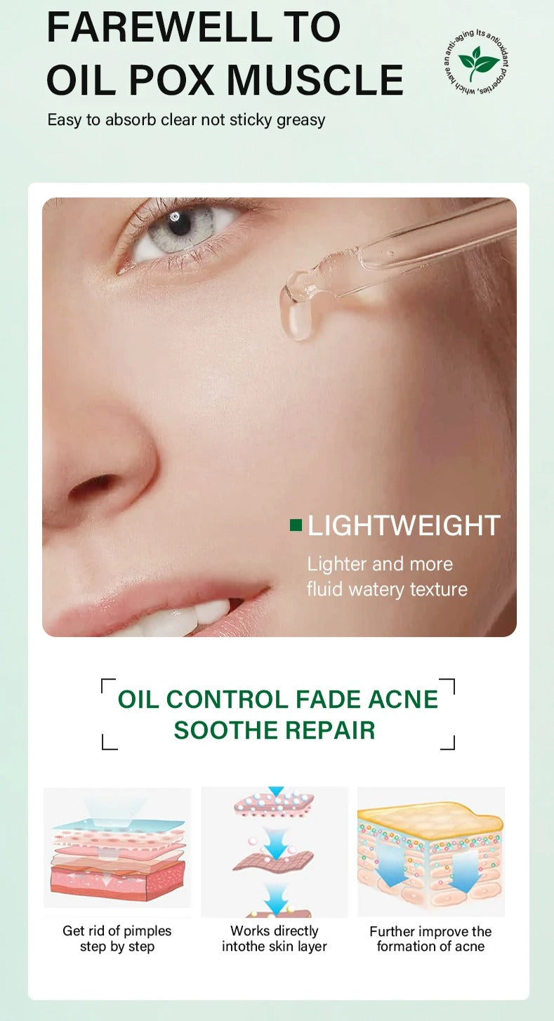 FORT Salicylic Acid Serum – Anti-Acne Face Serum & Dark Spot Correcting Serum for Glowing Skin | Acne Skin Care Products 30ml